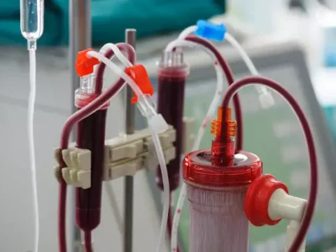 Home Dialysis Systems Market Expected to Expand Significantly at a 10.7% CAGR