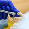 Titanium Dental Implants Market Forecasted to Grow at an 11.0% CAGR by 2035