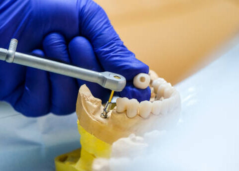 Titanium Dental Implants Market Forecasted to Grow at an 11.0% CAGR by 2035